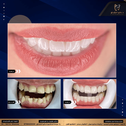 dr dalia shunnaq dental clinic