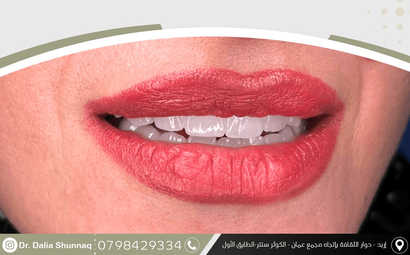 dr dalia shunnaq dental clinic