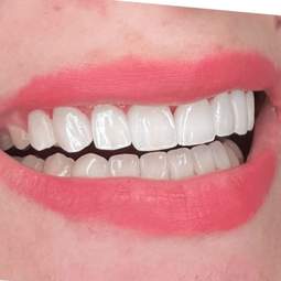 dr dalia shunnaq dental clinic