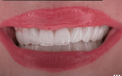 dr dalia shunnaq dental clinic