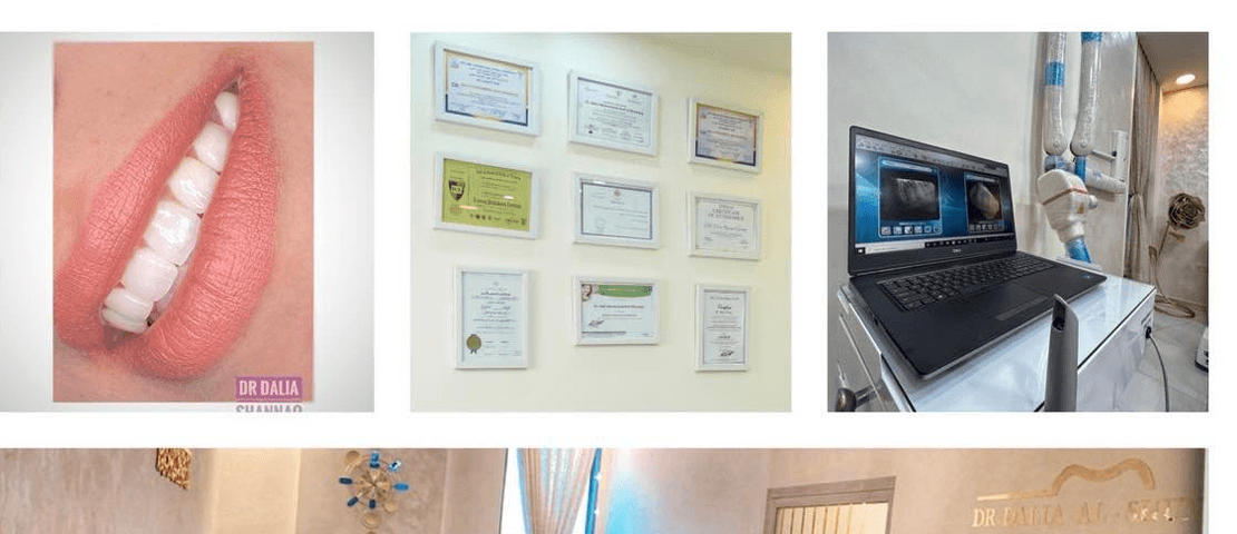 dr dalia shunnaq dental clinic