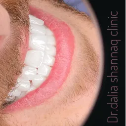 dr dalia shunnaq dental clinic